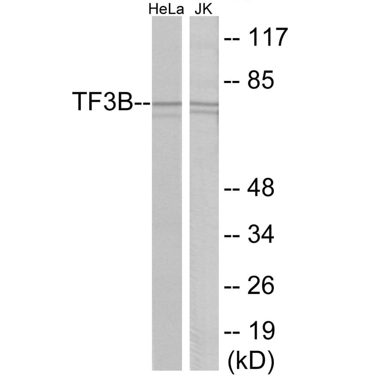 Western Blot - TF3B Cell Based ELISA Kit (CB6105) - Antibodies.com