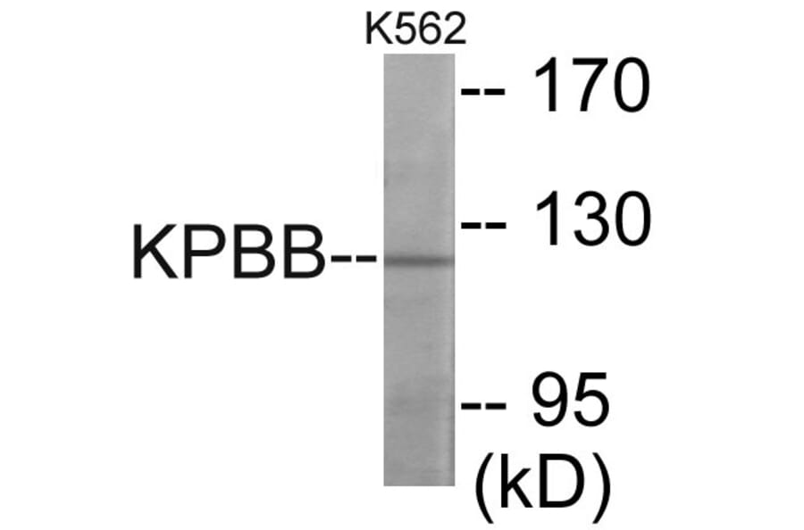 Western Blot - KPBB Cell Based ELISA Kit (CB6107) - Antibodies.com