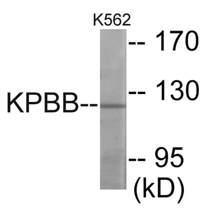 Western Blot - KPBB Cell Based ELISA Kit (CB6107) - Antibodies.com