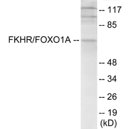 Western Blot - FKHR Cell Based ELISA Kit (CB6155) - Antibodies.com