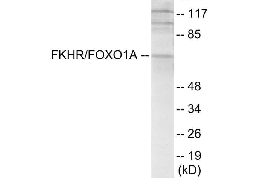 Western Blot - FKHR Cell Based ELISA Kit (CB6155) - Antibodies.com
