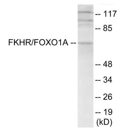 Western Blot - FKHR Cell Based ELISA Kit (CB6155) - Antibodies.com