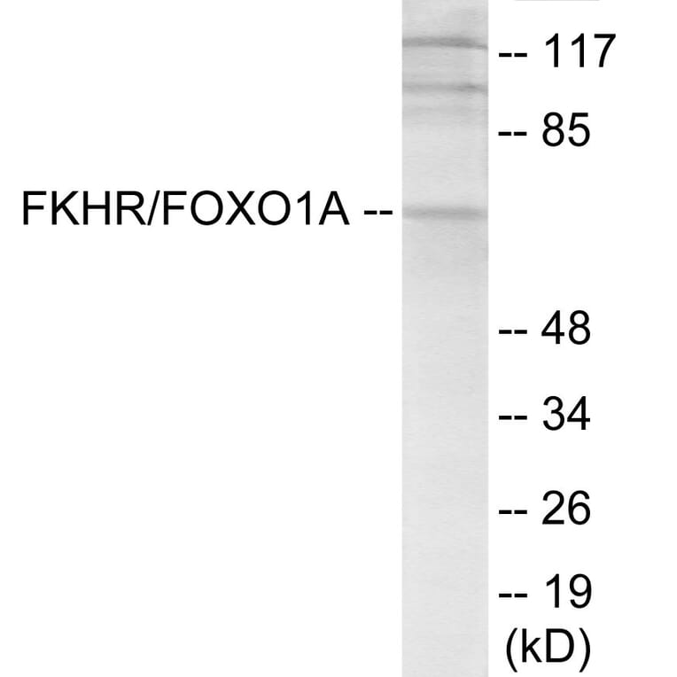 Western Blot - FKHR Cell Based ELISA Kit (CB6155) - Antibodies.com