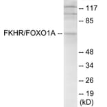 Western Blot - FKHR Cell Based ELISA Kit (CB6155) - Antibodies.com
