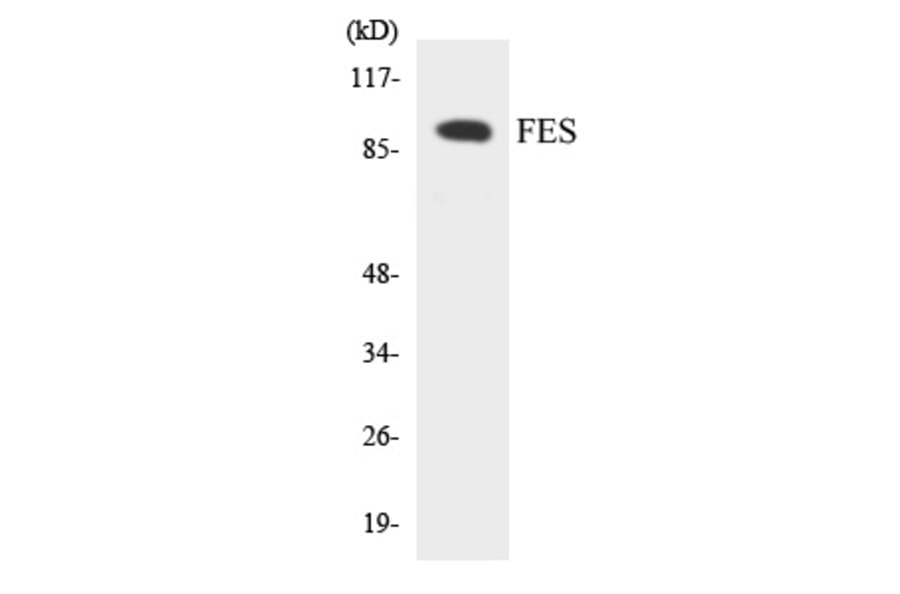 Western Blot - FES Cell Based ELISA Kit (CB5832) - Antibodies.com