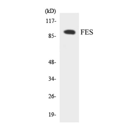 Western Blot - FES Cell Based ELISA Kit (CB5832) - Antibodies.com