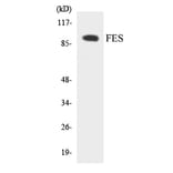 Western Blot - FES Cell Based ELISA Kit (CB5832) - Antibodies.com