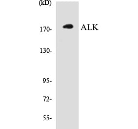 Western Blot - ALK Cell Based ELISA Kit (CB5032) - Antibodies.com