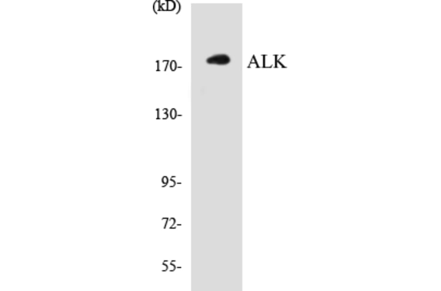 Western Blot - ALK Cell Based ELISA Kit (CB5032) - Antibodies.com