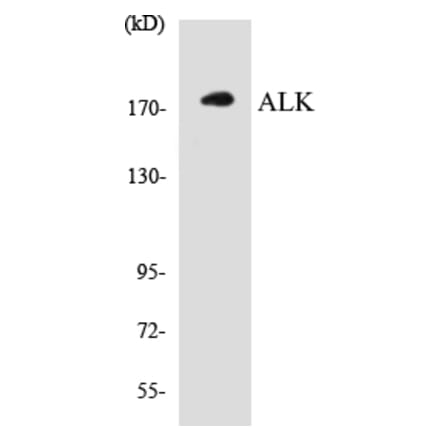 Western Blot - ALK Cell Based ELISA Kit (CB5032) - Antibodies.com