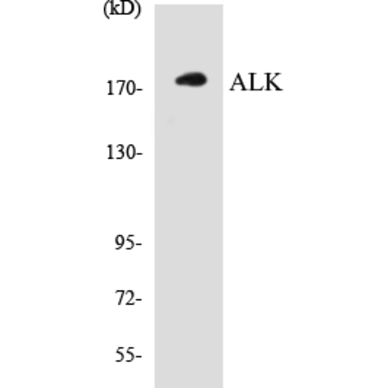 Western Blot - ALK Cell Based ELISA Kit (CB5032) - Antibodies.com