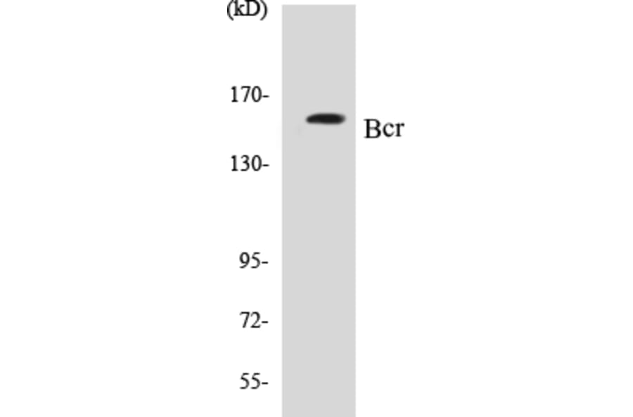 Western Blot - Bcr Cell Based ELISA Kit (CB5071) - Antibodies.com