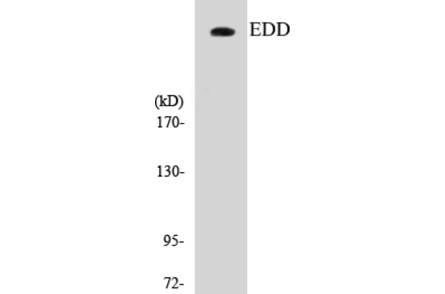 Western Blot - EDD Cell Based ELISA Kit (CB5219) - Antibodies.com
