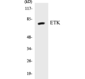 Western Blot - ETK Cell Based ELISA Kit (CB5251) - Antibodies.com