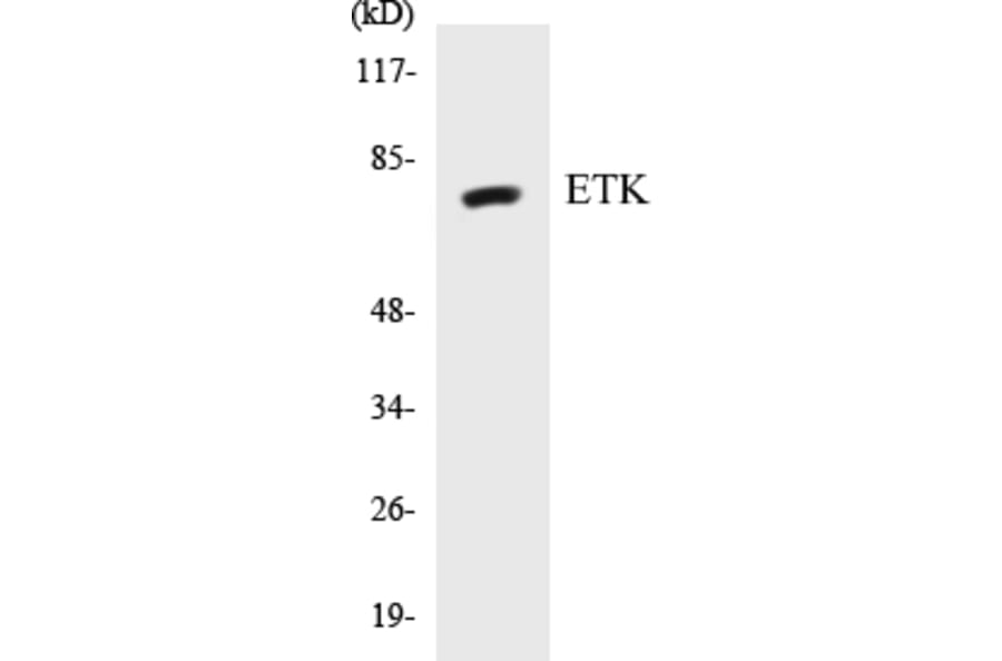 Western Blot - ETK Cell Based ELISA Kit (CB5251) - Antibodies.com