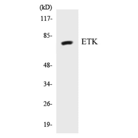 Western Blot - ETK Cell Based ELISA Kit (CB5251) - Antibodies.com