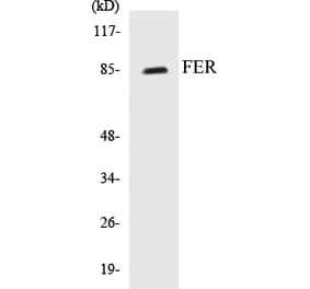 Western Blot - FER Cell Based ELISA Kit (CB5260) - Antibodies.com