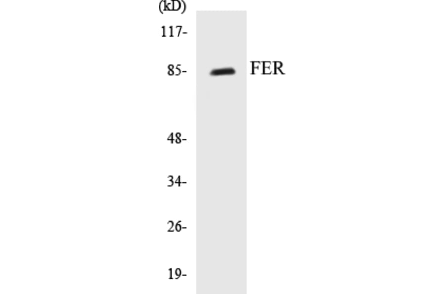 Western Blot - FER Cell Based ELISA Kit (CB5260) - Antibodies.com