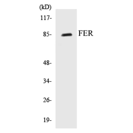 Western Blot - FER Cell Based ELISA Kit (CB5260) - Antibodies.com