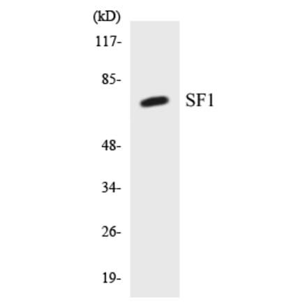 Western Blot - SF1 Cell Based ELISA Kit (CB5626) - Antibodies.com