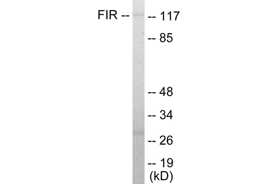 Western Blot - FIR Cell Based ELISA Kit (CB5813) - Antibodies.com