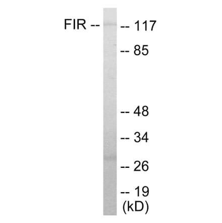 Western Blot - FIR Cell Based ELISA Kit (CB5813) - Antibodies.com