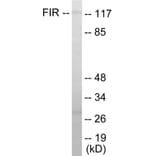 Western Blot - FIR Cell Based ELISA Kit (CB5813) - Antibodies.com