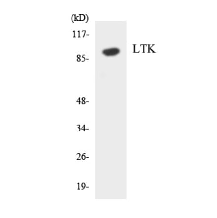 Western Blot - LTK Cell Based ELISA Kit (CB5871) - Antibodies.com