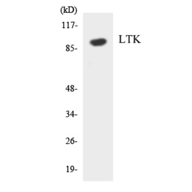 Western Blot - LTK Cell Based ELISA Kit (CB5871) - Antibodies.com