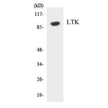 Western Blot - LTK Cell Based ELISA Kit (CB5871) - Antibodies.com