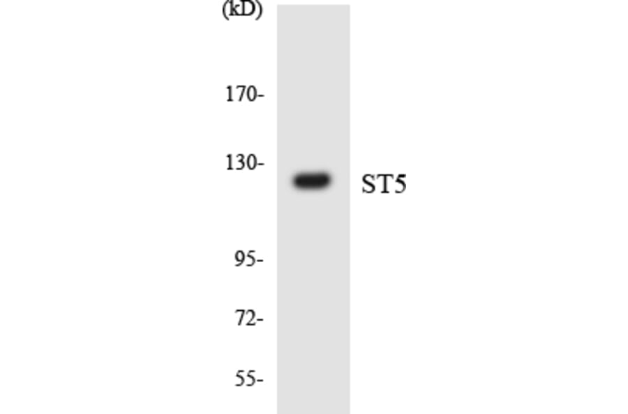 Western Blot - ST5 Cell Based ELISA Kit (CB5941) - Antibodies.com