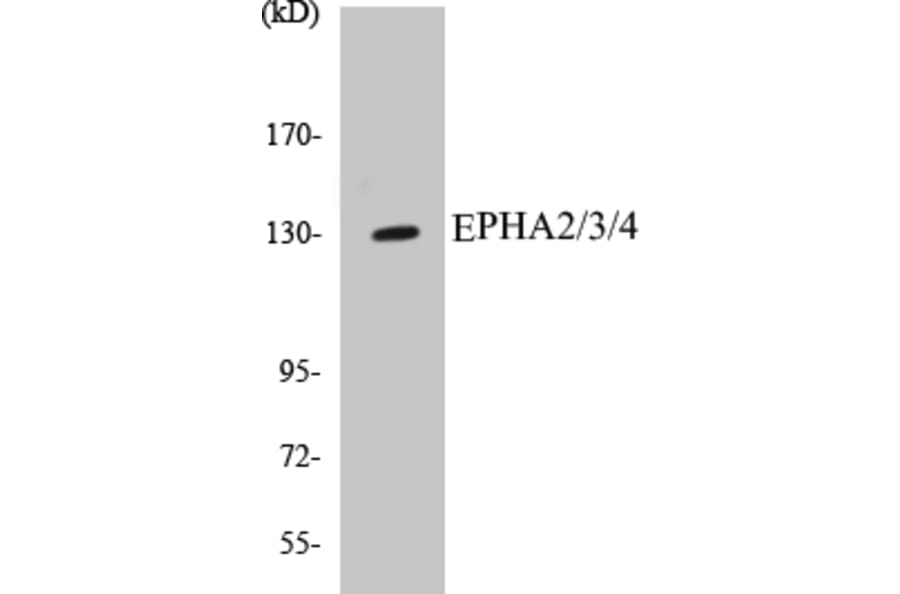 Western Blot - EPHA2 + 3 + 4 Cell Based ELISA Kit (CB5233) - Antibodies.com