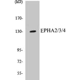 Western Blot - EPHA2 + 3 + 4 Cell Based ELISA Kit (CB5233) - Antibodies.com