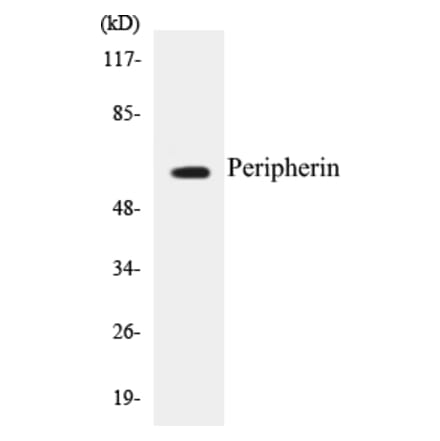 Western Blot - Peripherin Cell Based ELISA Kit (CB5549) - Antibodies.com