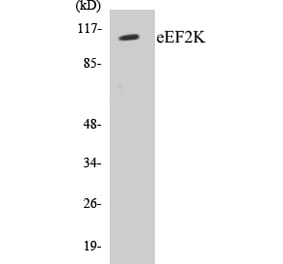 Western Blot - eEF2K Cell Based ELISA Kit (CB5221) - Antibodies.com