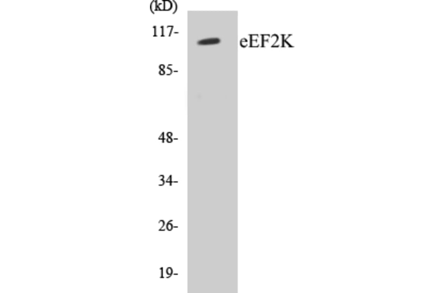Western Blot - eEF2K Cell Based ELISA Kit (CB5221) - Antibodies.com