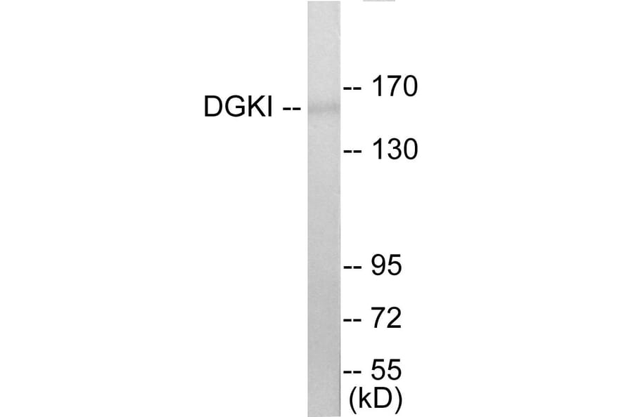 Western Blot - DGKI Cell Based ELISA Kit (CB5809) - Antibodies.com