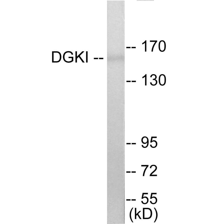 Western Blot - DGKI Cell Based ELISA Kit (CB5809) - Antibodies.com