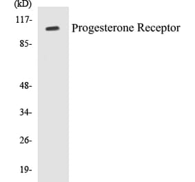 Western Blot - Progesterone Receptor Cell Based ELISA Kit (CB5587) - Antibodies.com