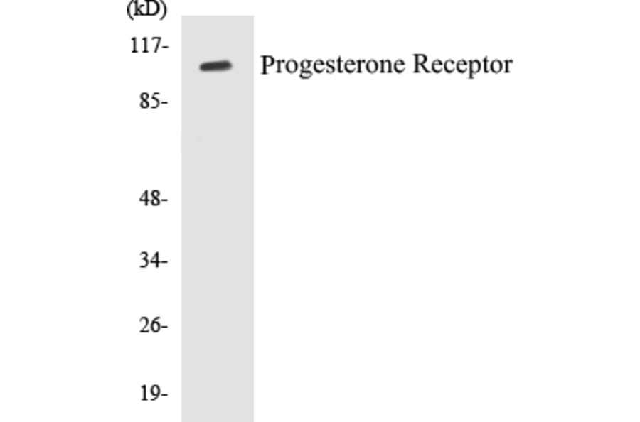 Western Blot - Progesterone Receptor Cell Based ELISA Kit (CB5587) - Antibodies.com
