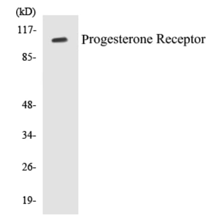 Western Blot - Progesterone Receptor Cell Based ELISA Kit (CB5587) - Antibodies.com