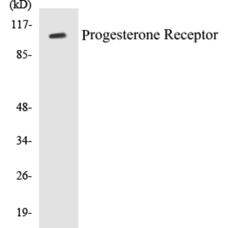 Western Blot - Progesterone Receptor Cell Based ELISA Kit (CB5587) - Antibodies.com