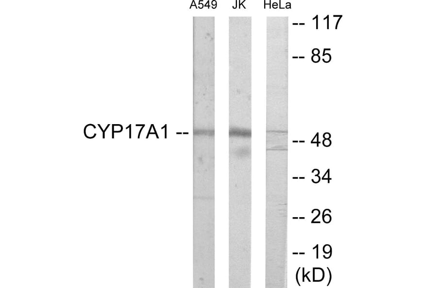 Western Blot - Cytochrome P45 017A1 Cell Based ELISA Kit (CB6121) - Antibodies.com