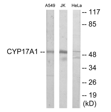 Western Blot - Cytochrome P45 017A1 Cell Based ELISA Kit (CB6121) - Antibodies.com