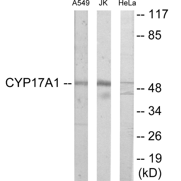 Western Blot - Cytochrome P45 017A1 Cell Based ELISA Kit (CB6121) - Antibodies.com