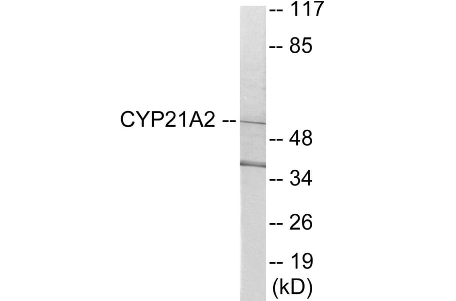 Western Blot - Cytochrome P45 021A2 Cell Based ELISA Kit (CB6123) - Antibodies.com