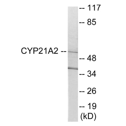 Western Blot - Cytochrome P45 021A2 Cell Based ELISA Kit (CB6123) - Antibodies.com