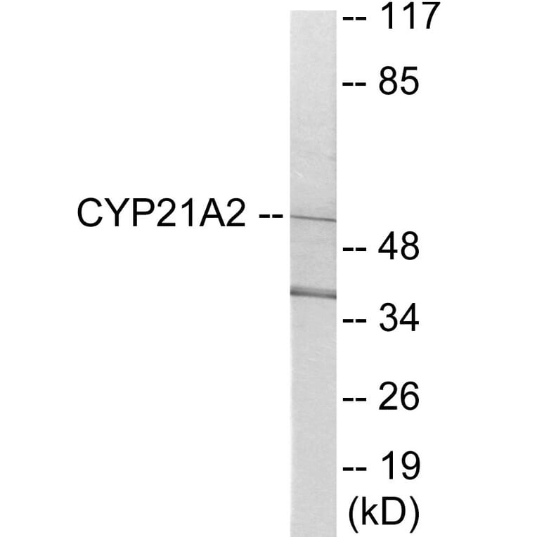 Western Blot - Cytochrome P45 021A2 Cell Based ELISA Kit (CB6123) - Antibodies.com