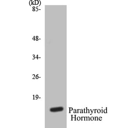 Western Blot - Parathyroid Hormone Cell Based ELISA Kit (CB5533) - Antibodies.com