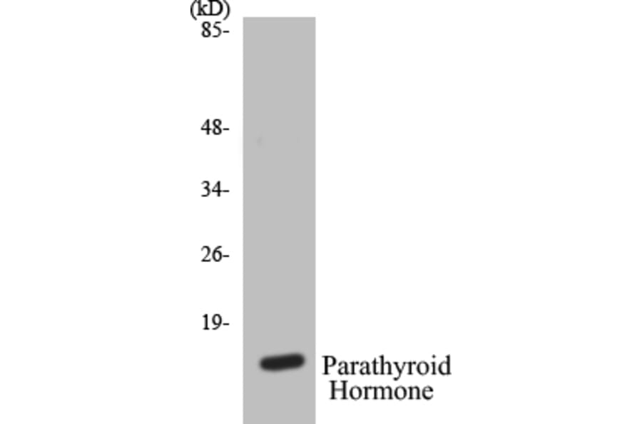 Western Blot - Parathyroid Hormone Cell Based ELISA Kit (CB5533) - Antibodies.com